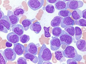 leukemia cells