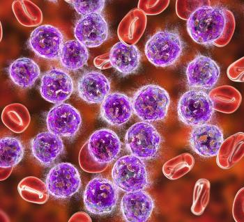 Illustration of myeloproliferative neoplasms, including essential thrombocythemia.