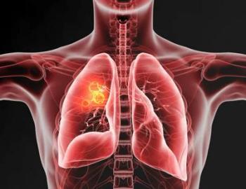 Illustration of lungs. 