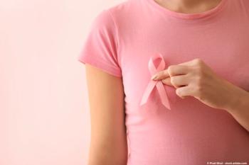 Camizestrant combo had a statistically significant and clinically meaningful improvement in PFS in advanced breast cancer; © Pixel-Shot - stock.adobe.com
