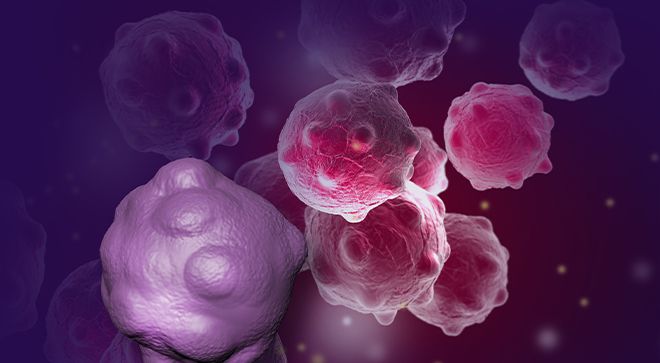 Image of nine cancer cells in breast cancer.