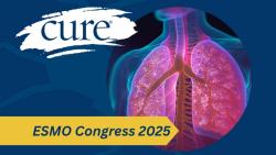 Imfinzi With Chemo Produces Inconclusive Outcomes in Phase 3 Mesothelioma Study