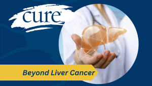 liver cancer