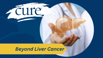liver cancer
