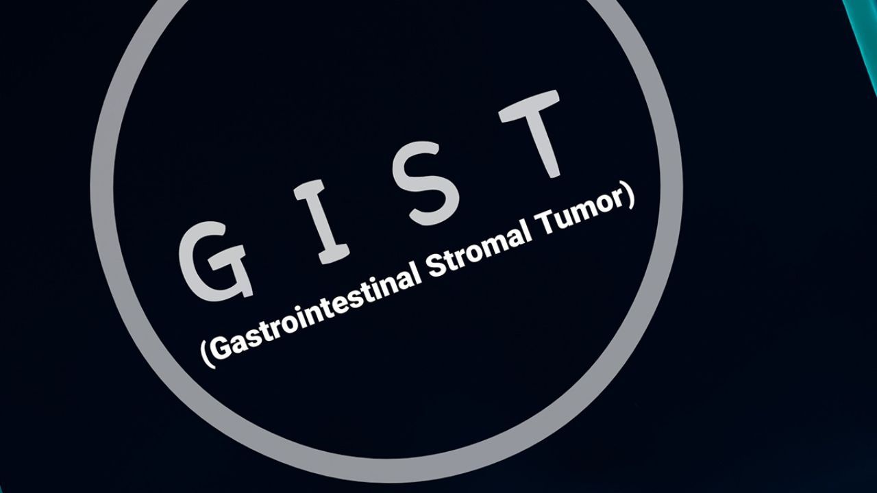 This patient guide explains gastrointestinal stromal tumors, covering diagnosis, treatment options, targeted therapies and practical care tips.