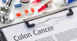 ctDNA Status May Predict Disease-Free Survival With Celebrex in Colon Cancer 