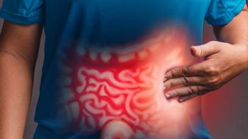 Stage 3 colon cancer patients who tested MRD+ with Signatera after surgery saw a meaningful survival benefit from Celebrex and chemo: © stock.adobe.com.