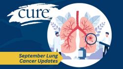 Top Lung Cancer News and Research Highlights from September 2025 