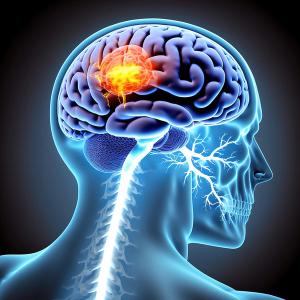 The End Brain Cancer Initiative is currently seeking Primary Central Nervous System Lymphoma patients and care partners to participate in an online roundtable discussion: © stock.adobe.com.