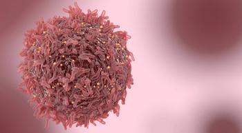 Image of a microscopic skin cancer cell.