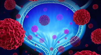 Investigational Drug Shows Promise in Patients with Metastatic Urothelial Cancer