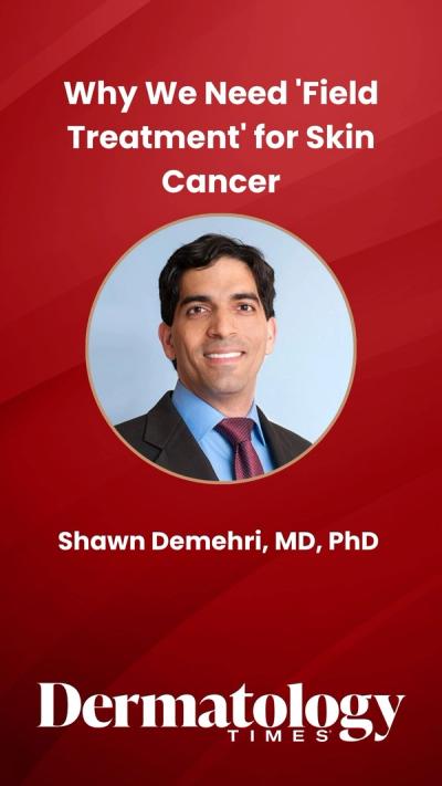 Why We Need 'Field Treatment' for Skin Cancer