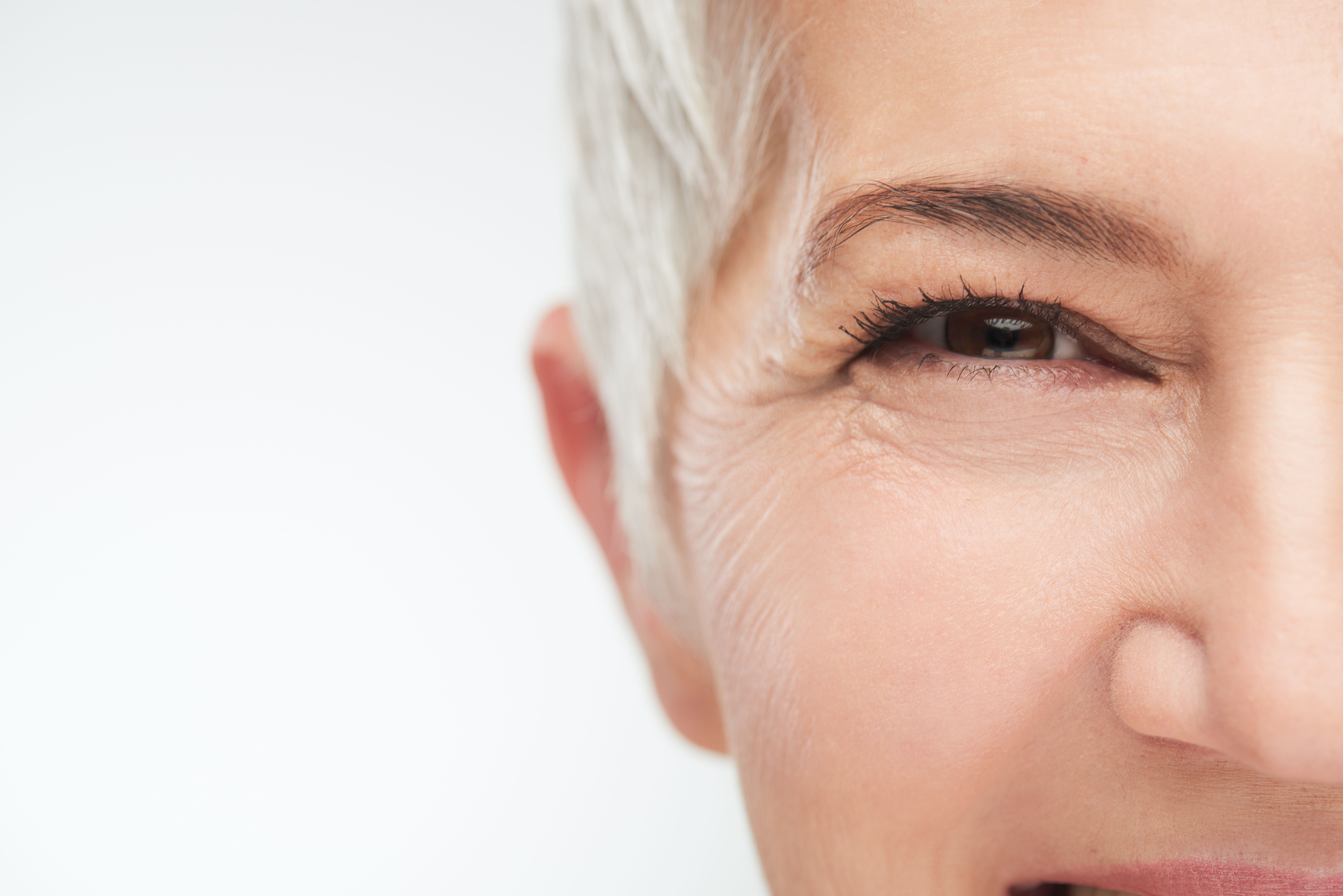 wrinkles