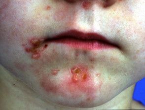 Review Explores Multifactorial Nature of Bone Health in Pediatric ...