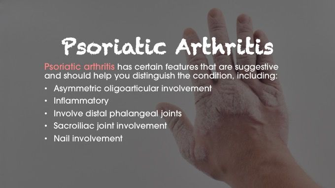 Psoriatic arthritis diagnosis