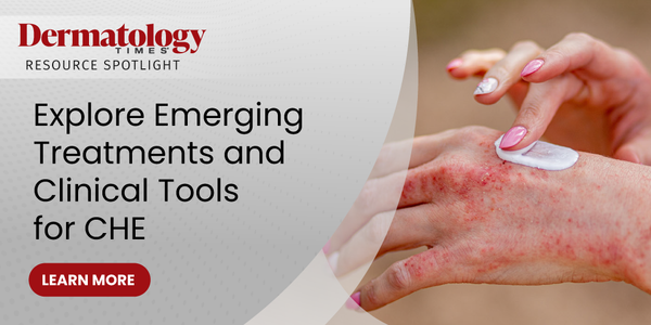 Explore Emerging Treatments and Clinical Tools for CHE