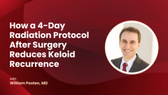 How a 4-Day Radiation Protocol After Surgery Reduces Keloid Recurrence