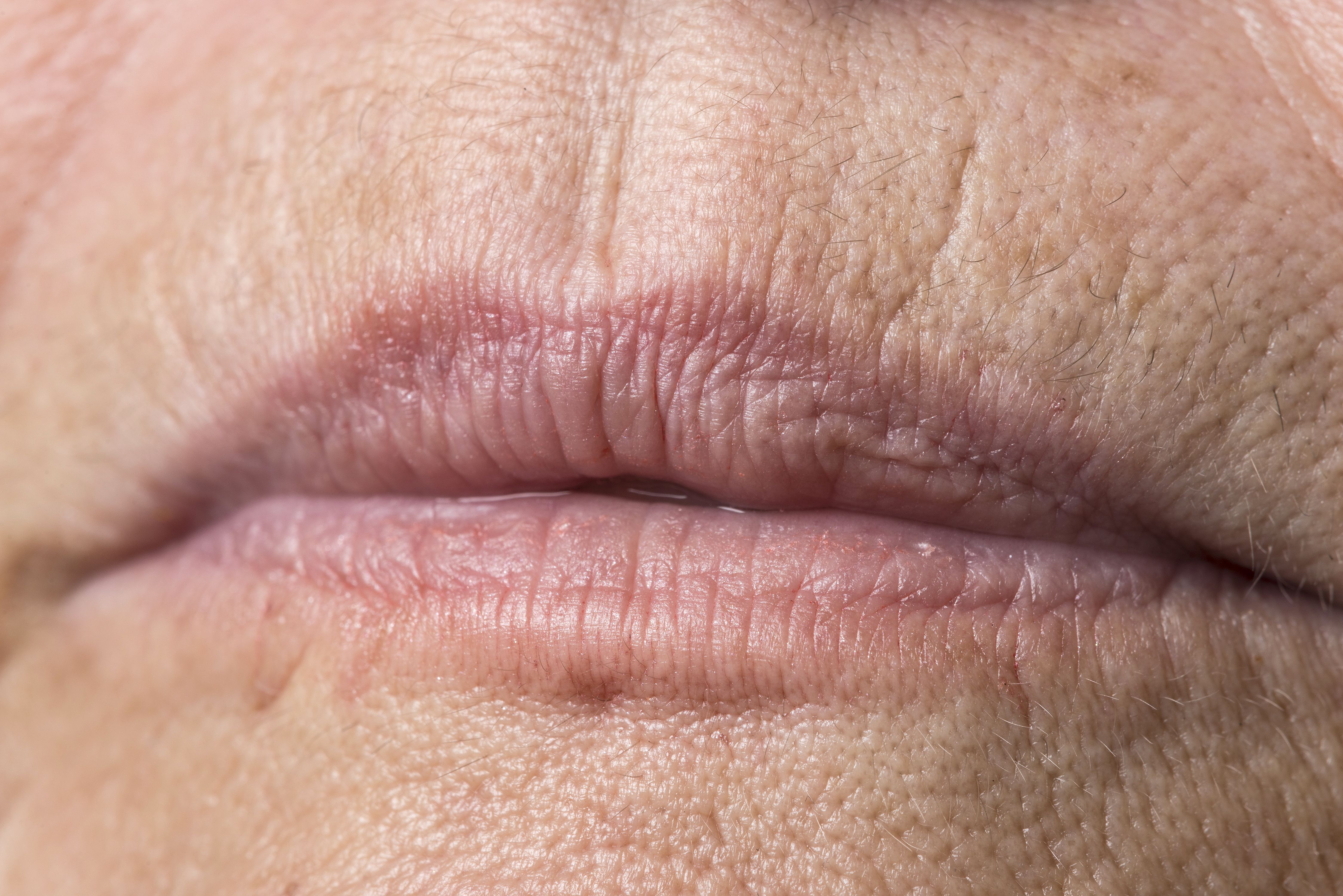 wrinkled lips