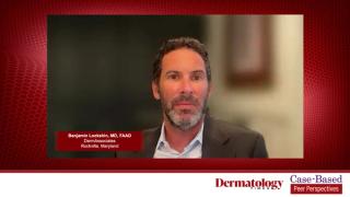 Case 2: Expert Opinions on Enhancing Patient Education of Vitiligo Treatment Risks and Benefits