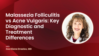 Malassezia Folliculitis vs Acne Vulgaris: Key Diagnostic and Treatment Differences