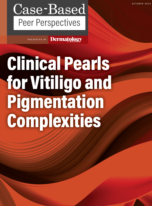 Clinical Pearls for Vitiligo and Pigmentation Complexities: Part 3