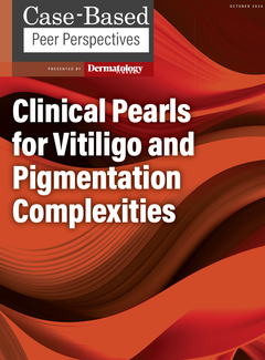 EP. 4 Clinical Pearls for Vitiligo and Pigmentation Complexities: Part 1