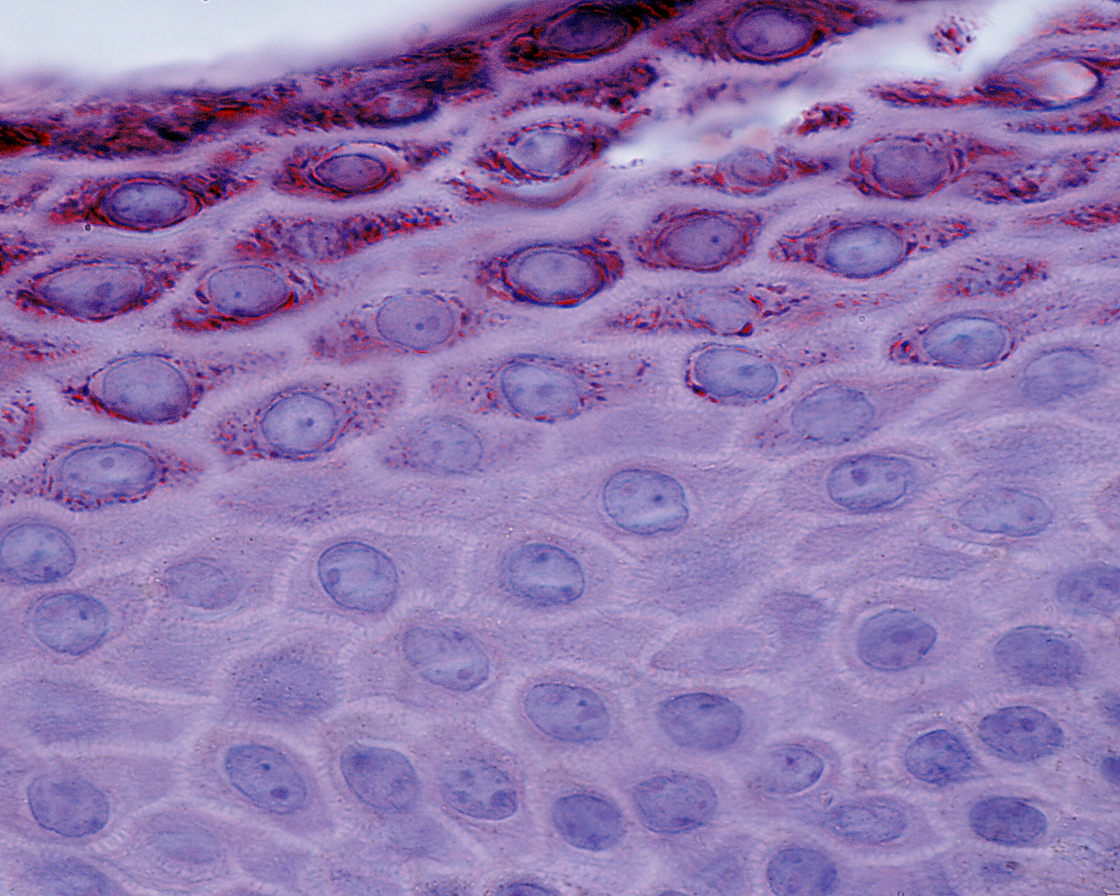 Шиповатый слой кожи под микроскопом