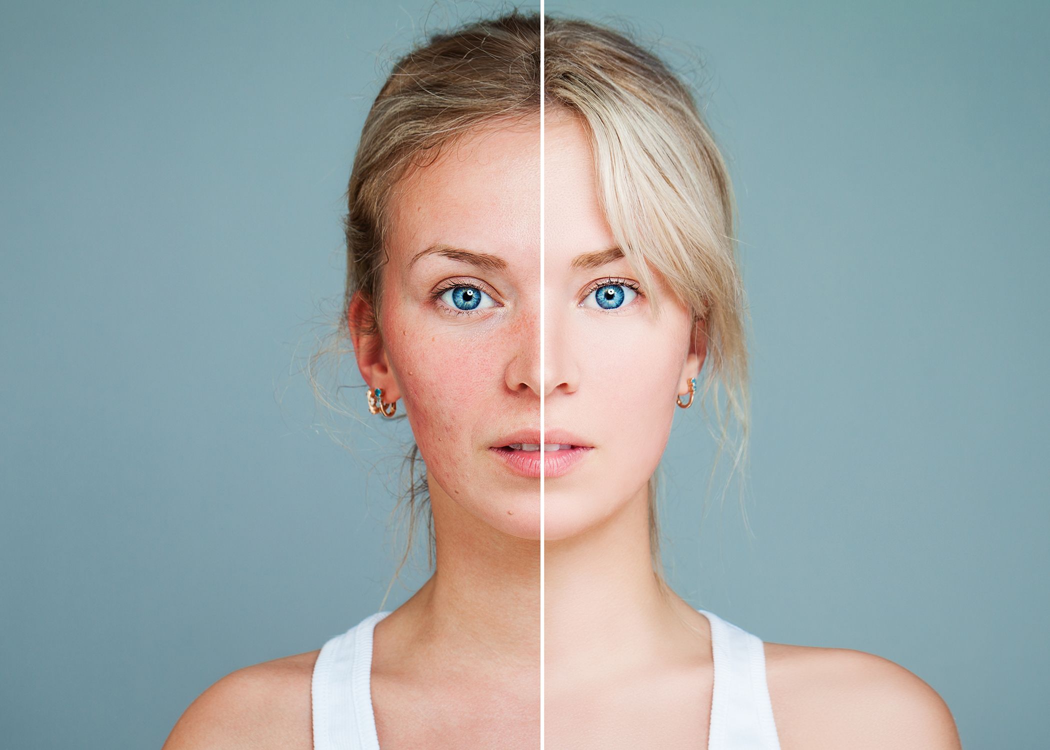 lasers and injectables