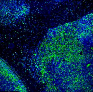 Immune Signatures Outperform Clinical Appearance in Treatment Guidance