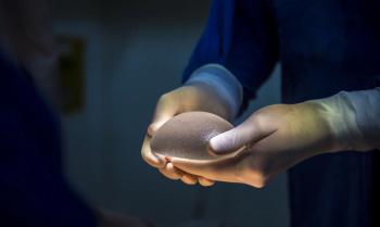 capsular contracture