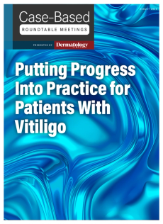 Dermatology Times, Putting Progress Into Practice for Patients With Vitiligo, August 2025 (Vol. 46. Supp. 04)