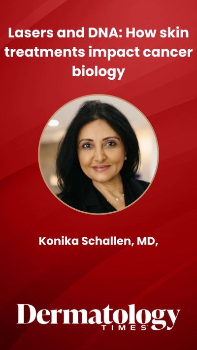 Lasers and DNA: How skin treatments impact cancer biology