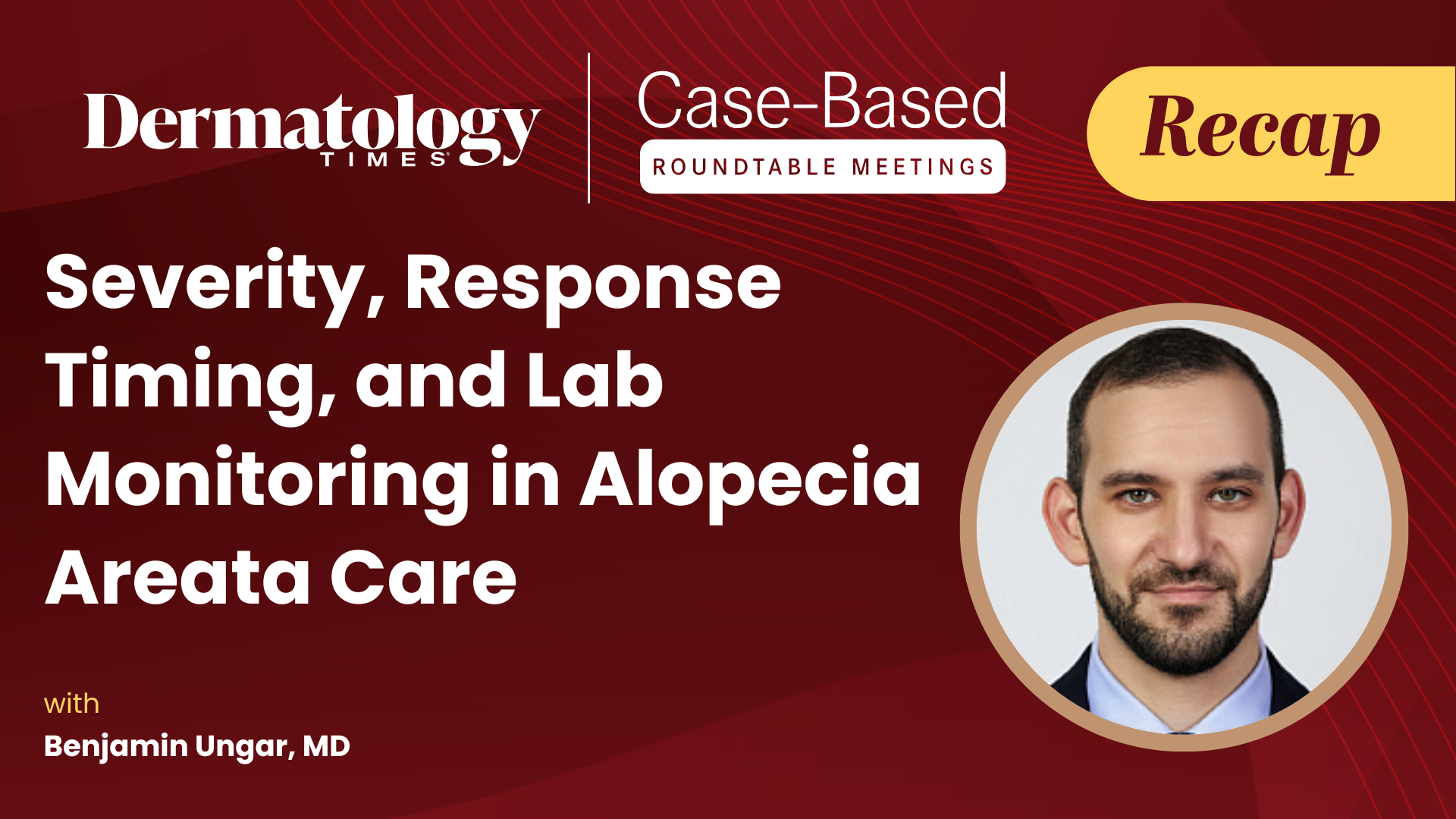 Severity, Response Timing, and Lab Monitoring in Alopecia Areata Care