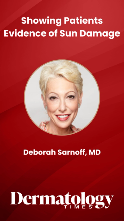 Showing Patients Evidence of Sun Damage