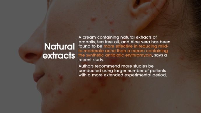 natural extracts for acne