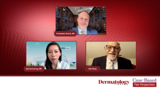 Case 1: Assessing a Systemic-Naive Patient With Occupational Plaque Psoriasis