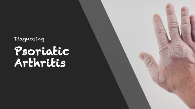 Diagnosing psoriatic arthritis