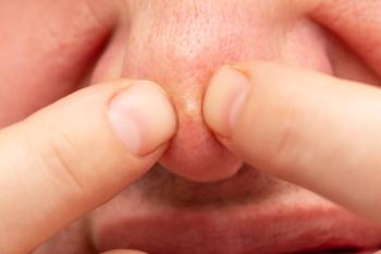 Nasal papule