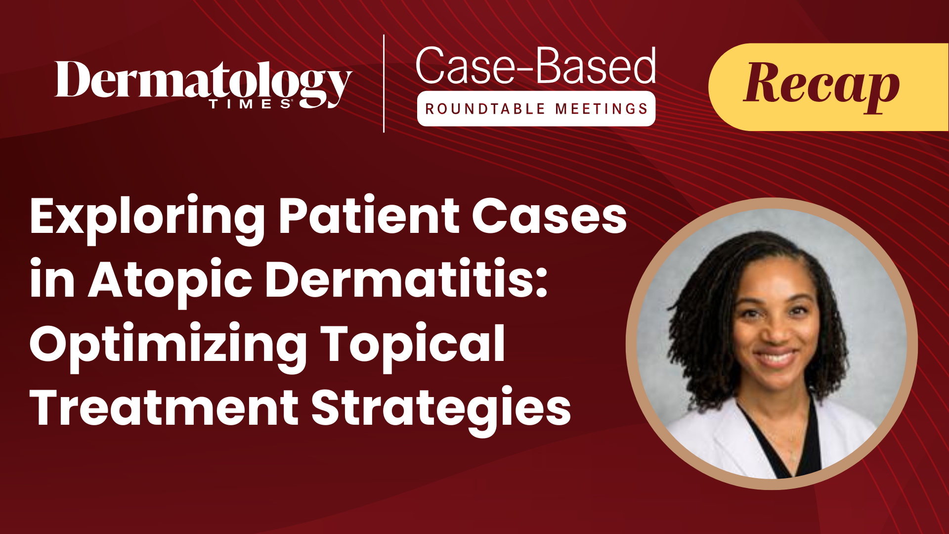 Topical Therapies Remain Central in Atopic Dermatitis Treatment Strategies