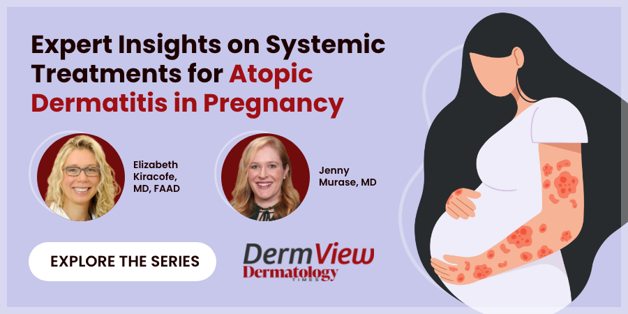 Expert Insights on Systemic Treatments for Atopic Dermatitis in Pregnancy