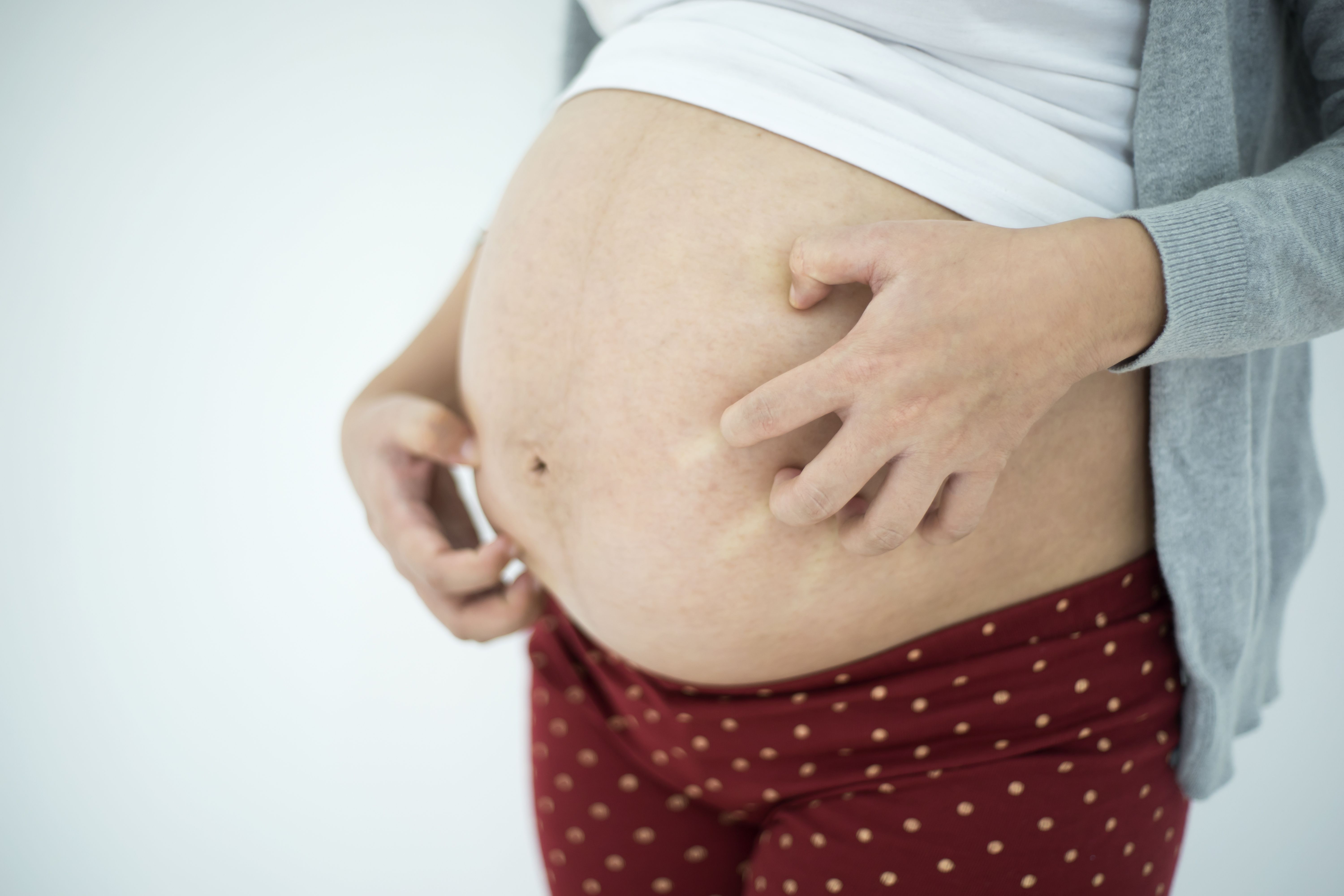 woman scratching pregnant stomach