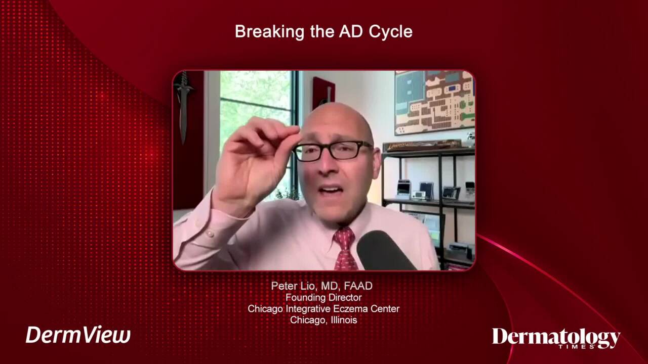 Experts discuss atopic dermatitis. 