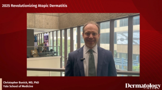 OX40/OX40L Inhibitors Offer Upstream Signaling Pathways in Atopic Dermatitis