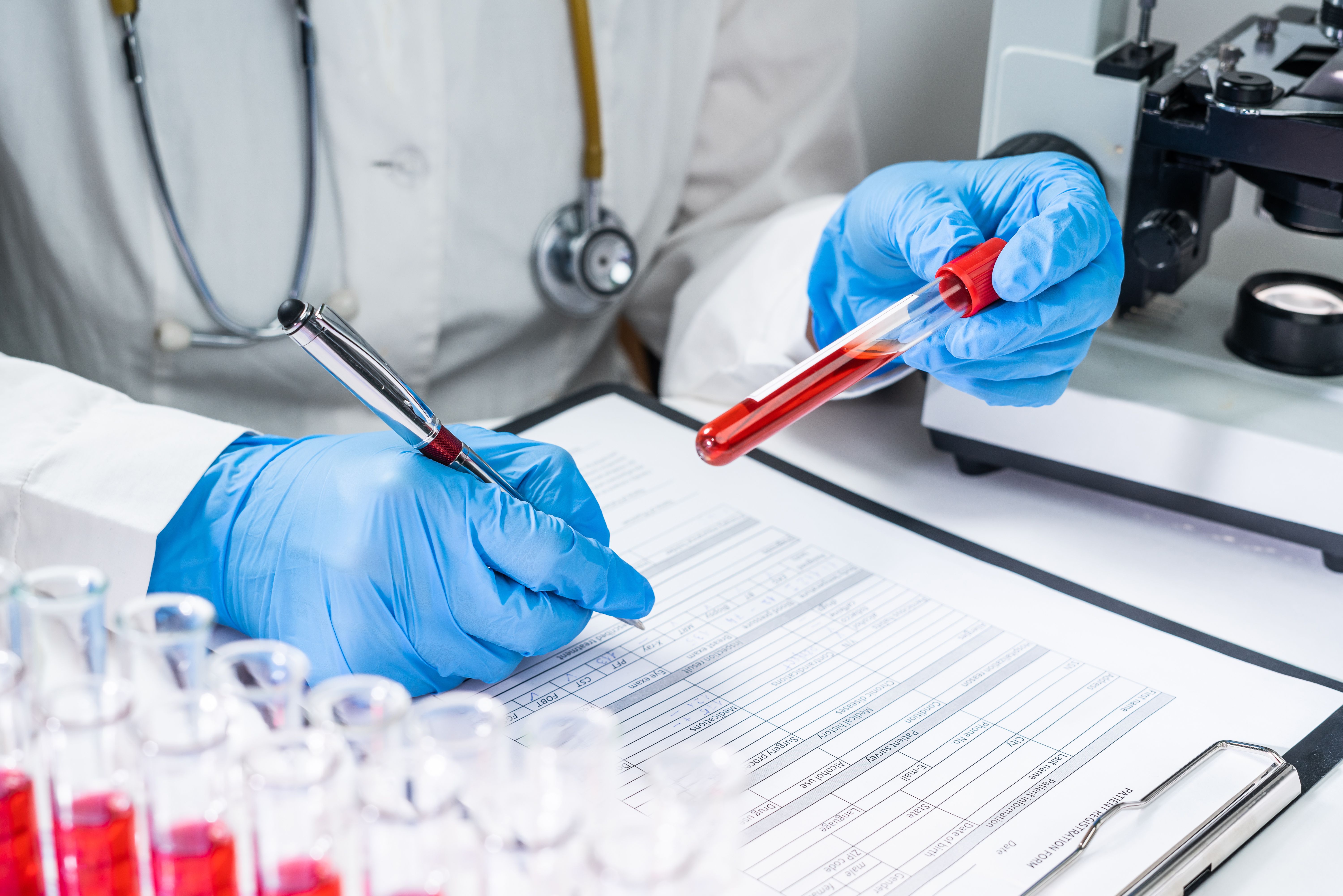 Monitoring Lab Test JAK Inhibitors and Lab Monitoring