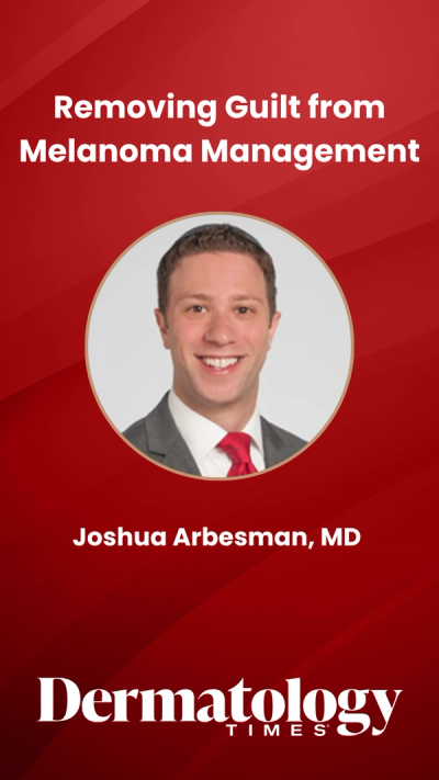 Removing Guilt from Melanoma Management