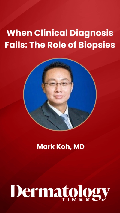 When Clinical Diagnosis Fails: The Role of Biopsies