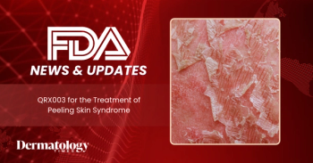 FDA Grants Fast Track Designation to QRX003 for Peeling Skin Syndrome