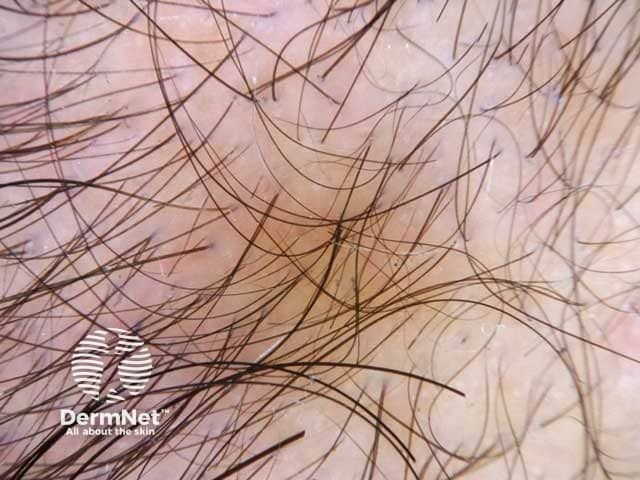 www.dermatologytimes.com
