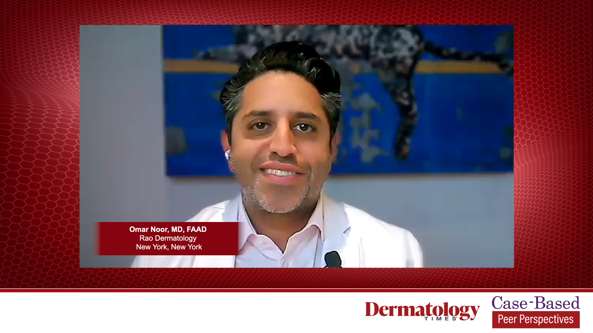 1 expert in this video