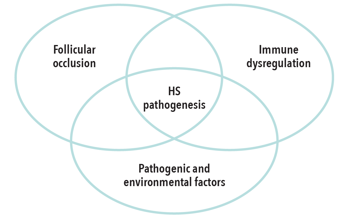 Hs Pathophys 3 Things You Should Know About the Pathogenesis and Treatment of HS